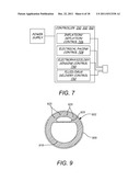 Device for Electrically and Mechanically Stimulating a Compartment in a     Body diagram and image