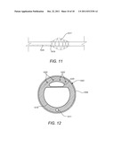 Device for Electrically and Mechanically Stimulating a Compartment in a     Body diagram and image