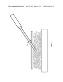 ULTRASONIC DEVICE FOR HARVESTING ADIPOSE TISSUE diagram and image