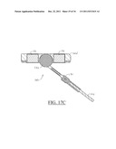 Medical Devices, Apparatuses, Systems, and Methods diagram and image