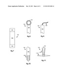 Bracing of Bundled Medical Devices for Single Port Entry, Robotically     Assisted Medical Procedures diagram and image