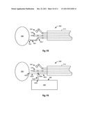 Bracing of Bundled Medical Devices for Single Port Entry, Robotically     Assisted Medical Procedures diagram and image