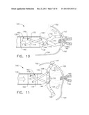 LAPAROSCOPIC SUTURE DEVICE WITH ASYNCHRONOUS IN-LINE NEEDLE MOVEMENT diagram and image