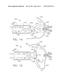 LAPAROSCOPIC SUTURE DEVICE WITH ASYNCHRONOUS IN-LINE NEEDLE MOVEMENT diagram and image