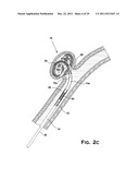 SYSTEM AND METHOD FOR MECHANICALLY POSITIONING INTRAVASCULAR IMPLANTS diagram and image