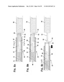 SYSTEM AND METHOD FOR MECHANICALLY POSITIONING INTRAVASCULAR IMPLANTS diagram and image