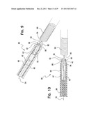 SYSTEM AND METHOD FOR MECHANICALLY POSITIONING INTRAVASCULAR IMPLANTS diagram and image