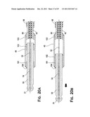 SYSTEM AND METHOD FOR MECHANICALLY POSITIONING INTRAVASCULAR IMPLANTS diagram and image