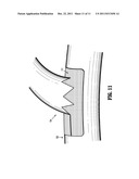 HEMOSTATIC PATCH diagram and image