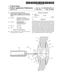 CLOSURE DEVICE WITH STRING RETRACTABLE UMBRELLA AND METHOD FOR CLOSING A     BODY OPENING WITH THE SAME diagram and image