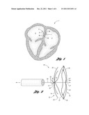 CLOSURE DEVICE WITH STRING RETRACTABLE UMBRELLA AND METHOD FOR CLOSING A     BODY OPENING WITH THE SAME diagram and image