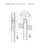 CLOSURE DEVICE WITH STRING RETRACTABLE UMBRELLA AND METHOD FOR CLOSING A     BODY OPENING WITH THE SAME diagram and image