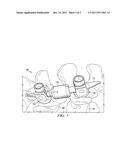 FLEXIBLE SPINAL STABILIZATION ELEMENT AND SYSTEM diagram and image