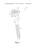 Spinal Facet Bone Screw System diagram and image
