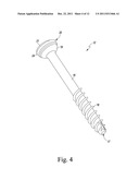 Spinal Facet Bone Screw System diagram and image
