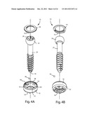 POLYAXIAL FACET FIXATION SCREW SYSTEM WITH FIXATION AUGMENTATION diagram and image