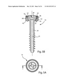 POLYAXIAL FACET FIXATION SCREW SYSTEM WITH FIXATION AUGMENTATION diagram and image