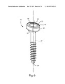 POLYAXIAL FACET FIXATION SCREW SYSTEM WITH FIXATION AUGMENTATION diagram and image