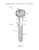 POLYAXIAL FACET FIXATION SCREW SYSTEM WITH FIXATION AUGMENTATION diagram and image