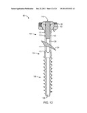 POLYAXIAL FACET FIXATION SCREW SYSTEM WITH FIXATION AUGMENTATION diagram and image