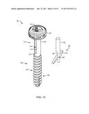 POLYAXIAL FACET FIXATION SCREW SYSTEM WITH FIXATION AUGMENTATION diagram and image