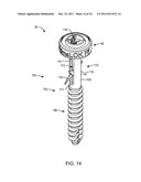 POLYAXIAL FACET FIXATION SCREW SYSTEM WITH FIXATION AUGMENTATION diagram and image