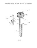 POLYAXIAL FACET FIXATION SCREW SYSTEM WITH FIXATION AUGMENTATION diagram and image