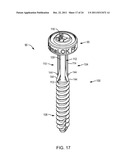 POLYAXIAL FACET FIXATION SCREW SYSTEM WITH FIXATION AUGMENTATION diagram and image