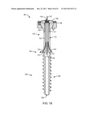 POLYAXIAL FACET FIXATION SCREW SYSTEM WITH FIXATION AUGMENTATION diagram and image