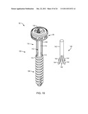 POLYAXIAL FACET FIXATION SCREW SYSTEM WITH FIXATION AUGMENTATION diagram and image