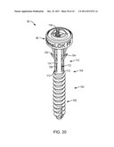 POLYAXIAL FACET FIXATION SCREW SYSTEM WITH FIXATION AUGMENTATION diagram and image