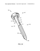 POLYAXIAL FACET FIXATION SCREW SYSTEM WITH FIXATION AUGMENTATION diagram and image