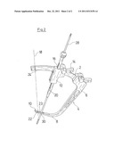 SURGICAL GUIDING DEVICE FOR RECONSTRUCTION OF ANTERIOR CRUCIATE LIGAMENT diagram and image