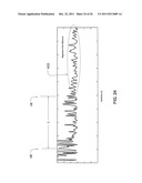 ACOUSTIC DETECTION FOR RESPIRATORY TREATMENT APPARATUS diagram and image