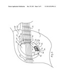 GUITAR SOUND HOLE GUARD AND METHODOLOGY OF APPLICATION diagram and image