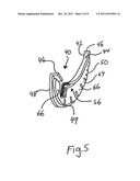 GUITAR SOUND HOLE GUARD AND METHODOLOGY OF APPLICATION diagram and image