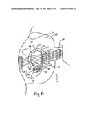 GUITAR SOUND HOLE GUARD AND METHODOLOGY OF APPLICATION diagram and image