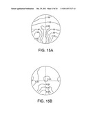 Progressive Power Eyeglass Lens and Design Method Thereof diagram and image
