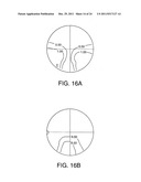 Progressive Power Eyeglass Lens and Design Method Thereof diagram and image