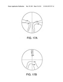 Progressive Power Eyeglass Lens and Design Method Thereof diagram and image