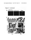 METHODS AND COMPOSITIONS FOR DIAGNOSIS AND TREATMENT OF CANCER diagram and image