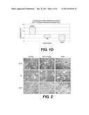 TARGETING PAX2 FOR THE TREATMENT OF BREAST CANCER diagram and image