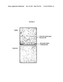 FRIZZLED-BINDING AGENTS AND USES THEREOF diagram and image