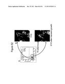 FRIZZLED-BINDING AGENTS AND USES THEREOF diagram and image