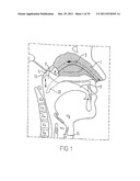 NASAL DELIVERY diagram and image