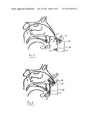 NASAL DELIVERY diagram and image