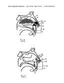 NASAL DELIVERY diagram and image