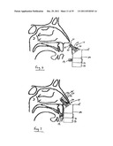 NASAL DELIVERY diagram and image