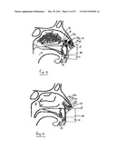 NASAL DELIVERY diagram and image