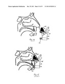 NASAL DELIVERY diagram and image